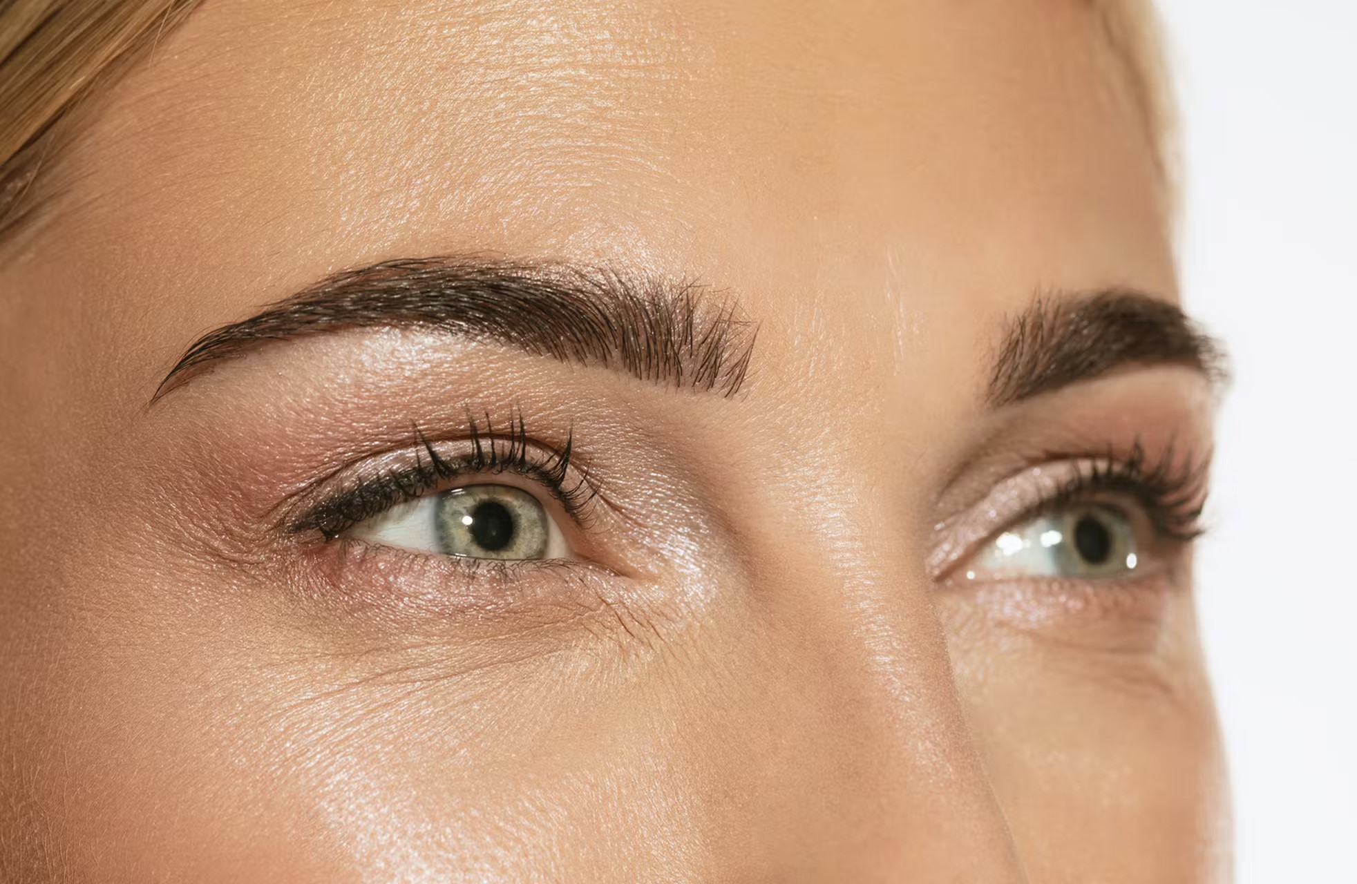 Upper Eyelid Blepharoplasty