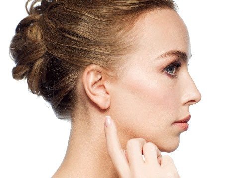 Rhinoplasty Before